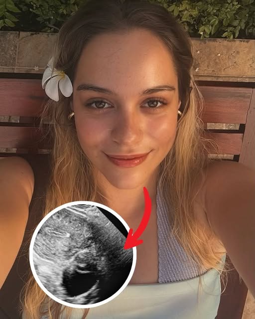 Shocking: Actress Hailey Pinto is pregnant, the child is from Home And Away actor, he is 10 years older than her