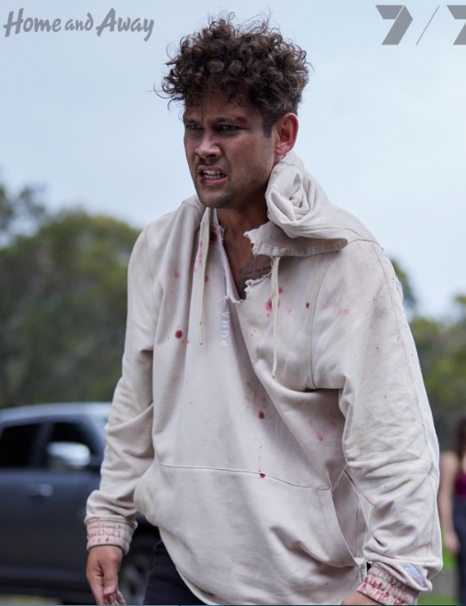 Home and Away Star Kyle Shilling Hides Health Scare While Filming — Is Mali’s Future at Risk?